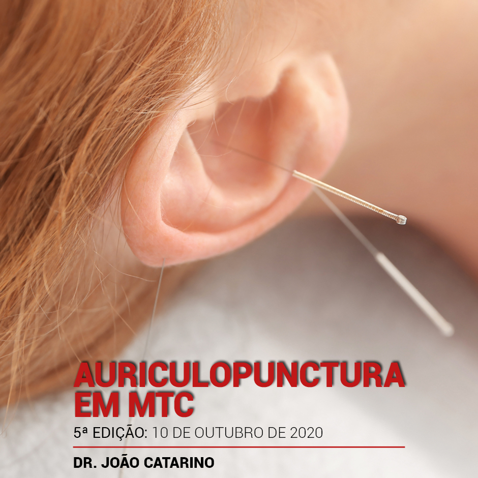 Post Auriculopunctura 5ed 101020
